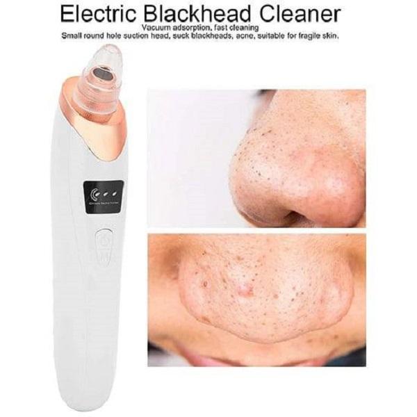 Blackhead Remover Vacuum Acne Cleaner 5-in-1 Spots Removal Device